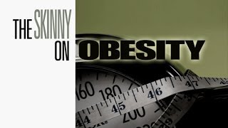 The Complete Skinny on Obesity [upl. by Friedrich]