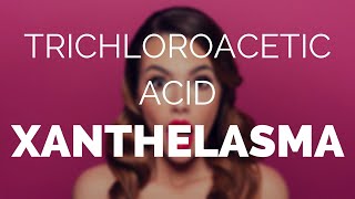 Trichloroacetic acid xanthelasma does it work [upl. by Bayer]