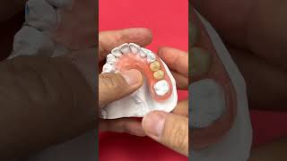 REMOVABLE PARTIAL DENTURE [upl. by Divadnhoj]