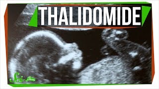 Thalidomide The Chemistry Mistake That Killed Thousands of Babies [upl. by Sileas869]