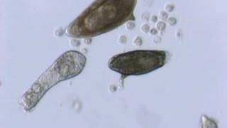 Schistosoma mansoni mother sporocyst and eggs [upl. by Nikolaos]