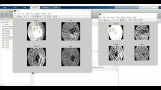 Retina Image Segmentation With Wavelet Transform From Scratch Matlab Code [upl. by Eciral853]