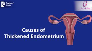 What causes Endometrial thickness  DrSmitha Sha of Cloudnine Hospitals  Doctors Circle [upl. by Aidile616]