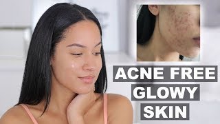 HOW I KEEP MY SKIN CLEAR amp ACNE FREE  Marie Jay [upl. by Georgetta]