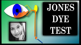 Jones Dye Test  1 amp 2  Lacrimal Drainage Disorders  Oculoplasty [upl. by Eiramnaej]