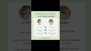 Cystic Acne vs Lipoma acne jerawat drlyna prplututdrlyna prplututklinikprimernilampuri [upl. by Audry]