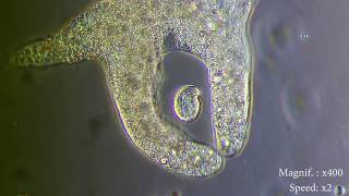 Amoeba eats paramecia  Amoebas lunch   Amoeba Endocytosis  Phagocytosis Part 1  👌 [upl. by Fania]