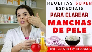 Acabe com as MANCHAS NA PELE inclusive MELASMA  Receita Caseira [upl. by Htebazila]