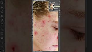 Blemish Removal and Frequency Separation AMAZING photoshop highendskinretouching photoediting [upl. by Aciruam756]