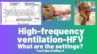 High frequency ventilation l Settings on HFV [upl. by Dinsmore795]