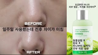 이지마인드 그린토마토 모공앰플 일주일 사용 후기 l 일주일만에 효과가 이정도 모공세럼 모공앰플 추천 [upl. by Seravaj]