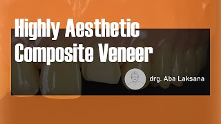 Direct Composite Veneer with 2 Layers Technique  Dental Aesthetic Restoration AMARIS® VOCO GmbH [upl. by Anerbes60]