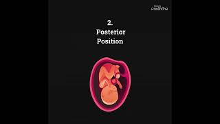 Learn about the Fetal Position in the 9th Month of Pregnancy [upl. by Sirtaeb]