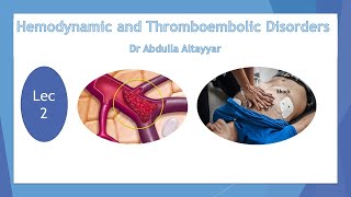 Hemodynamic Disorders and Thromboembolic Disease Lecture2 محاضرة أمراض قلبية متعددة [upl. by Eiznik]