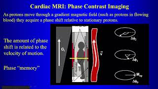 5b Cardiac MRI P2 [upl. by Enialahs508]