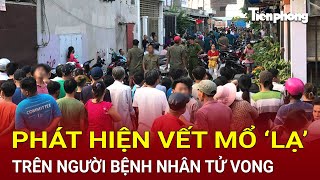 Bản tin thời sự  Phát hiện vết mổ ‘lạ’ trên người bệnh nhân tử vong Công an khẩn cấp vào cuộc [upl. by Naed]