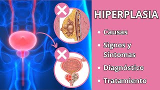 HIPERPLASIA  Causas signos y síntomas diagnóstico y tratamiento [upl. by Marquardt]