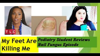 Podiatry Student reviews Brandon Never Washes His Feet  My Feet Are Killing Me nailfungus [upl. by Jeffcott]