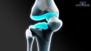 Tout savoir sur le cartilage [upl. by Offen723]