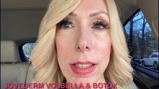 MY EXPERIENCE WITH JUVEDERM VOLBELLA AND BOTOX  Lip Filler [upl. by Melleta460]