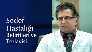 Sedef Hastalığının Belirtileri ve Tedavi Yöntemlerini Prof Dr Mustafa Özdemir Anlatıyor [upl. by Lledor]