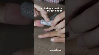 Mallet finger splint demo [upl. by Maura]