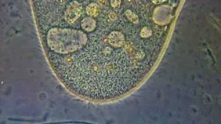 Paramecium  phase contrast microscope [upl. by Ssor]