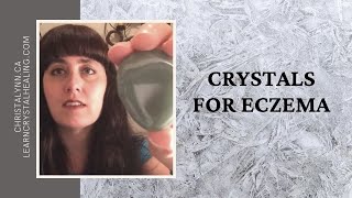 Crystals for Eczema [upl. by Canice]