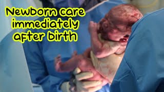 Newborn care immediately after birth in hospital newbornbaby [upl. by Valonia841]