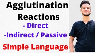 Agglutination Reaction Microbiology Agglutination Test [upl. by Dicks4]