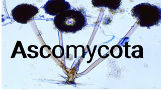 Ascomycota Advance Knowledge 1st year biology [upl. by Forsta]