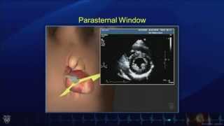 Echo Tutorial Comprehensive Transthoracic Echocardiogram  Mayo Clinic [upl. by Renelle]