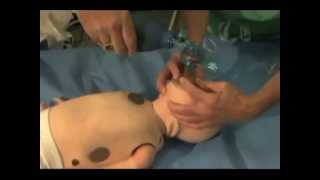 Bag Valve Mask BVM Ventilation in Pediatrics [upl. by Sayce]