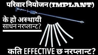 के हो अस्थायी साधन नरप्लान्टफाइदा र बेफाइदा केके छनFamily planning Methods norplant  implant [upl. by Ailee]