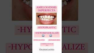 AMELOGENESIS IMPERFECTA dental anomalies enameldefects imperfecta [upl. by Acinorej]