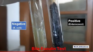 Bile Esculin Test Positive and Negative Demonstration [upl. by Hamaso]