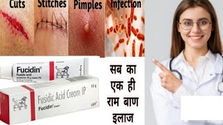 Fucidin Cream  Fucidic Acid Cream  ointment हिन्दी में Uses side effects  Honest review [upl. by Ardnuasal]