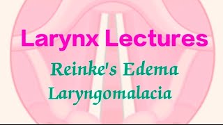 Reinkes Edema  Laryngomalacia [upl. by Aicilev372]