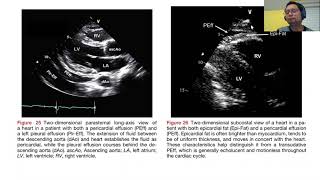 All about pericardium [upl. by Euqinamod]