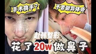 【川大发】三年三次鼻修复！光是鼻子就花了20w！我的鼻整形心路历程｜手术换手｜赴韩整形｜ [upl. by Yesnil788]