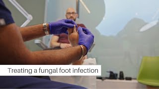 Flawless Feet foot and nail fungal infection advice [upl. by Luapnhoj]