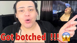 Did my lips and nose got botched  Vlog [upl. by Assira674]