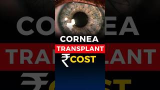 Cornea Transplant Cost [upl. by Kutzenco]