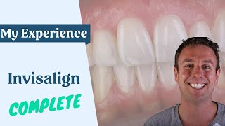 My Invisalign Experience Part 6  Finally complete [upl. by Afton]