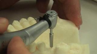 Dental implant surgery training video [upl. by Kudva469]