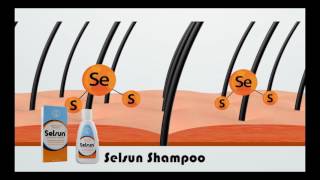 Selsun AntiDandruff Shampoo [upl. by Notsrik928]