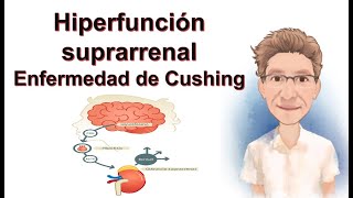 HIPERFUNCIÓN SUPRARRENAL ENFERMEDAD DE CUSHING [upl. by Aihsenrad]