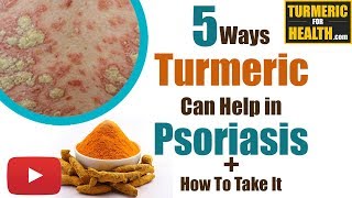 5 WAYS TURMERIC CAN HELP IN PSORIASIS [upl. by Noirb]