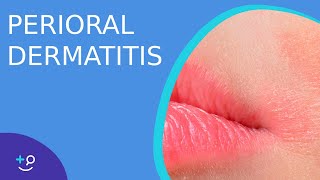 Perioral Dermatitis  Daily Dos of Dermatology [upl. by Tnomed]