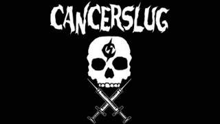 CANCERSLUG  PUSSYBOY [upl. by Arrait]